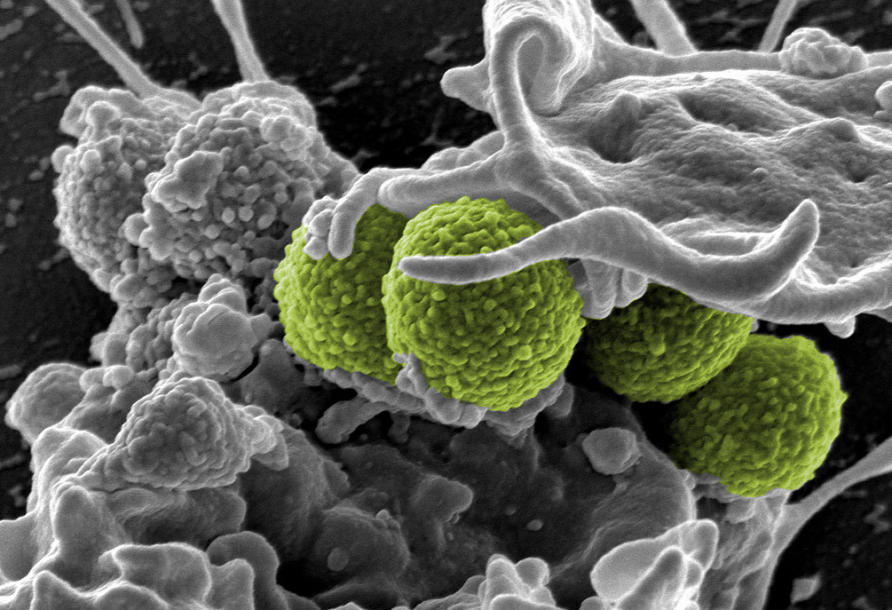 Credit: University of Melbourne